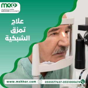 علاج تمزق الشبكية