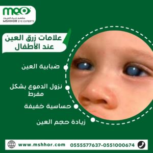  علامات زرق العين عند الأطفال 