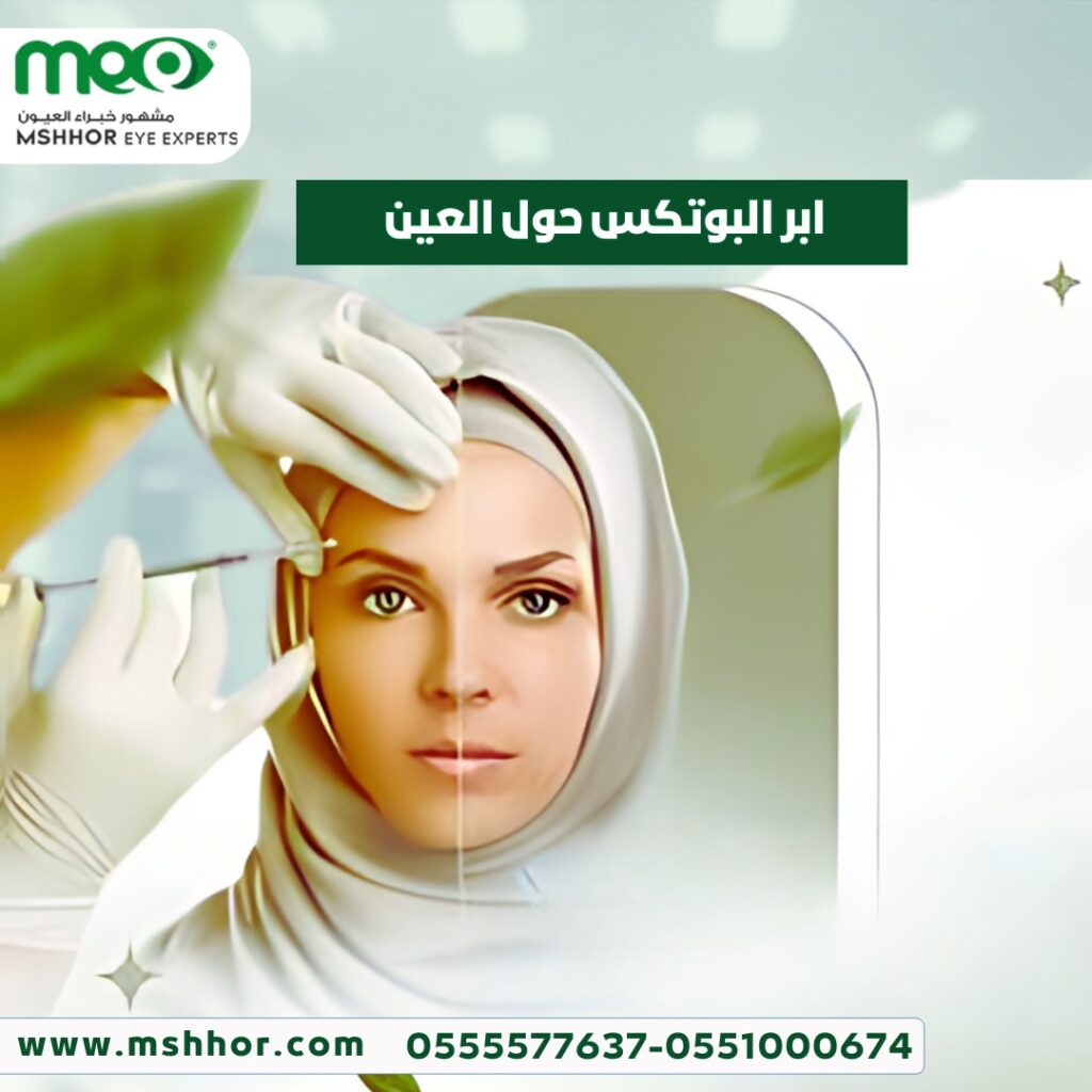 ابر البوتكس