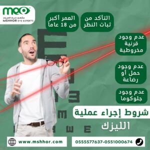 شروط إجراء عملية الليزك