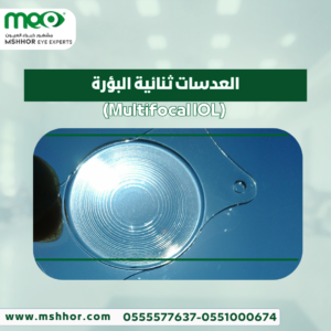 العدسات ثنائية البؤرة (Multifocal IOL)