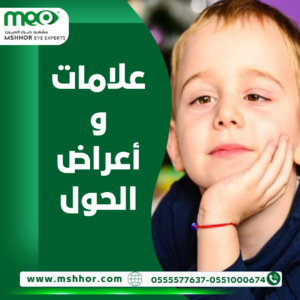 علامات و أعراض الحول