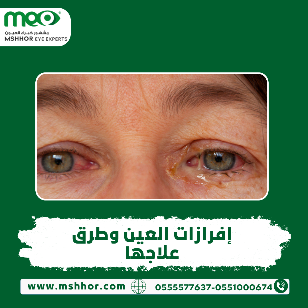افرازات العين وطرق علاجها