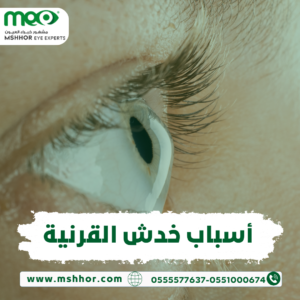 أسباب خدش القرنية