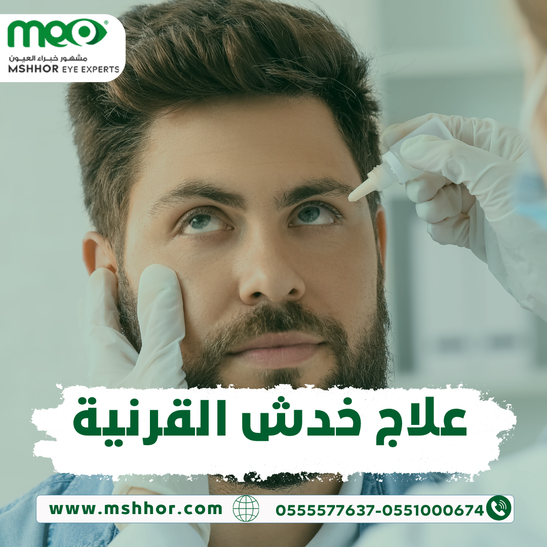 علاج خدش القرنية