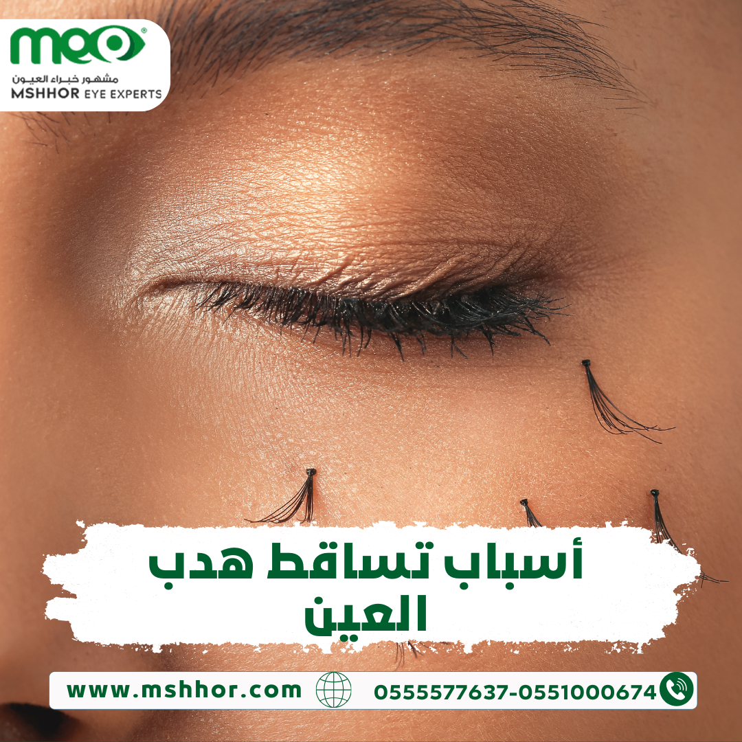 أسباب تساقط هدب العين