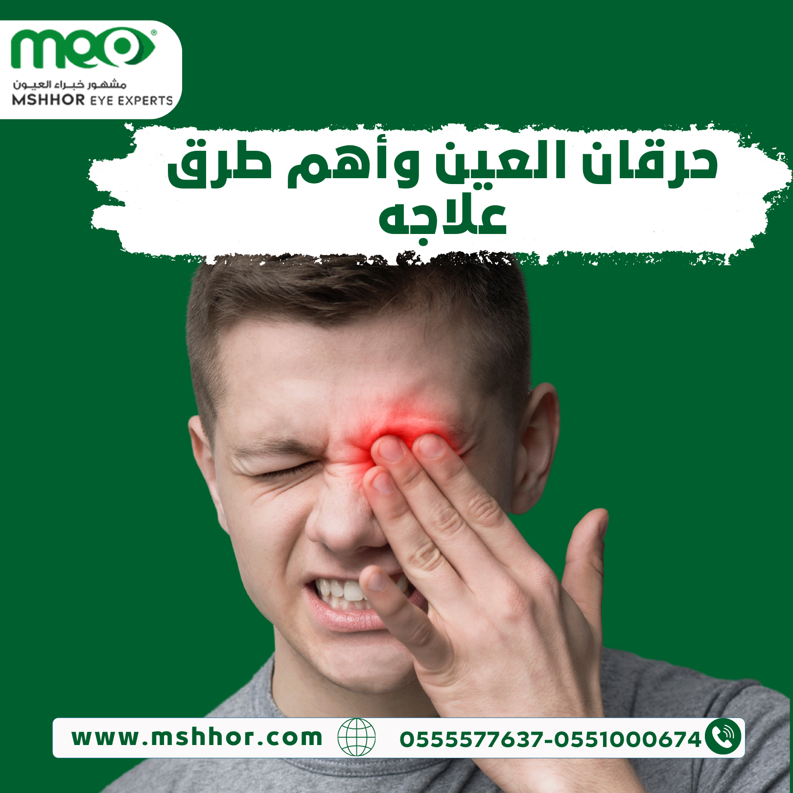 حرقان العين وأهم طرق علاجه