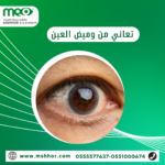 ما سبب رؤية وميض ضوء في العين