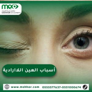 أسباب العين اللاارادية