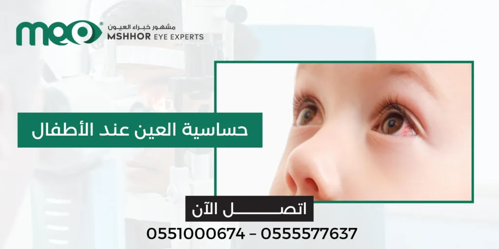 حساسية العين عند الأطفال