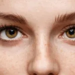 الحول الوحشي