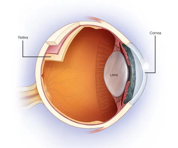 انواع الاستجماتيزم