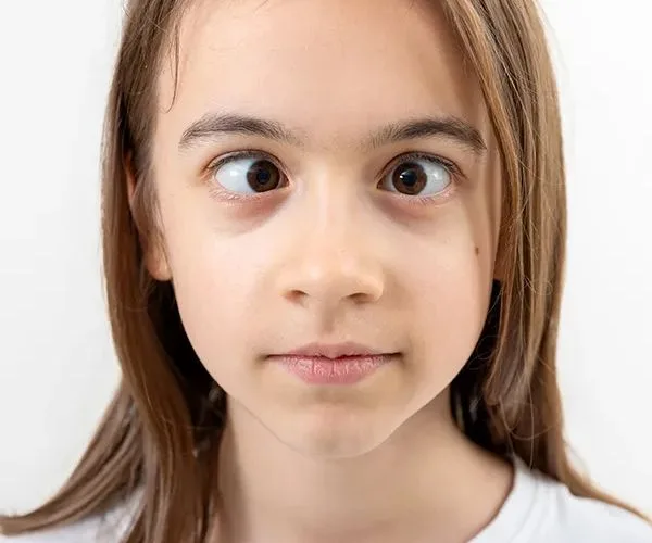 سبب حول العين المفاجئ عند الاطفال