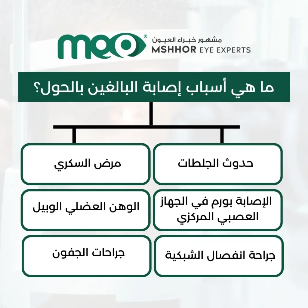 تجربتي مع عملية الحول