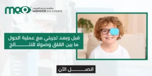 تجربتي مع عملية الحول