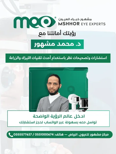 مركز مشهور لجراحة العيون