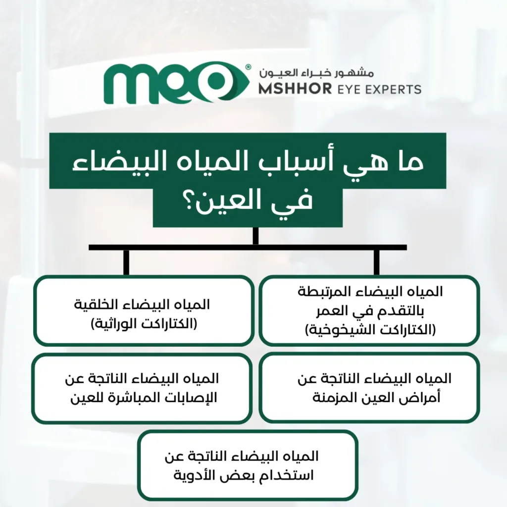 أسباب الماء البيضاء في العين