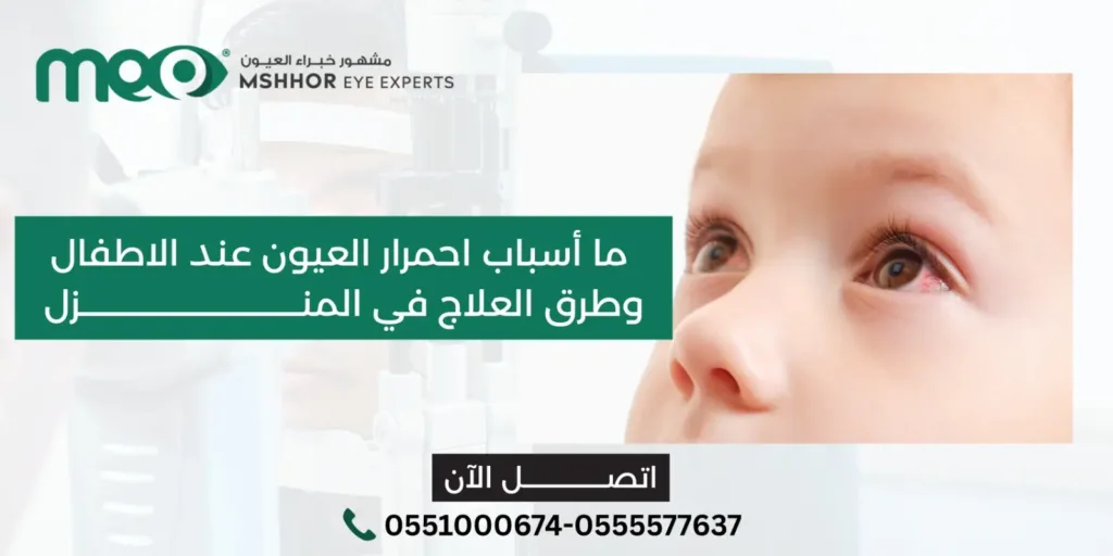 احمرار العيون عند الاطفال