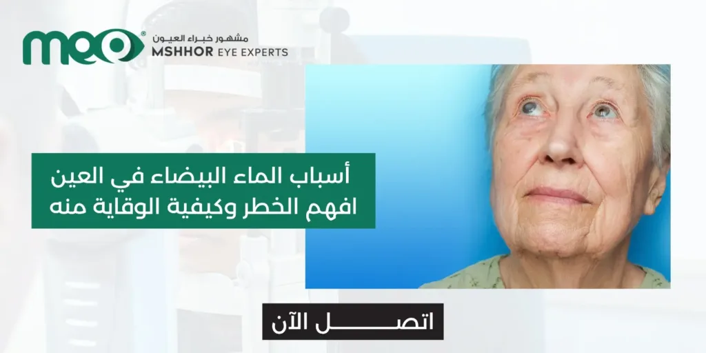 أسباب الماء البيضاء في العين