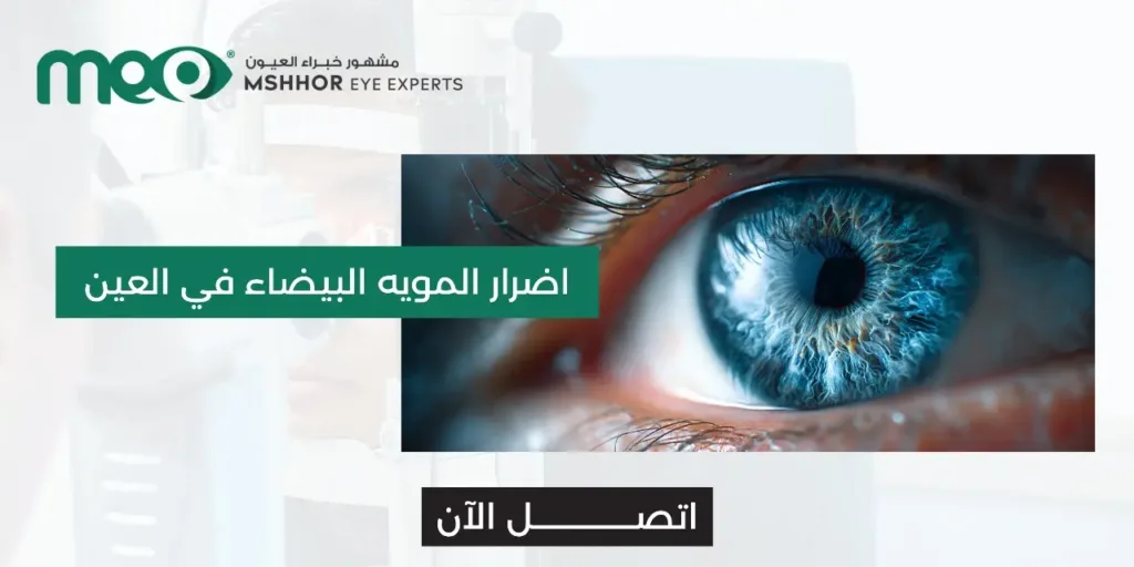 اضرار المويه البيضاء في العين