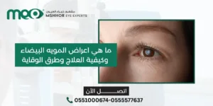 اعراض المويه البيضاء