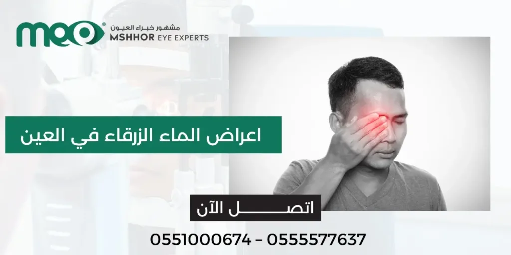 اعراض الماء الزرقاء في العين