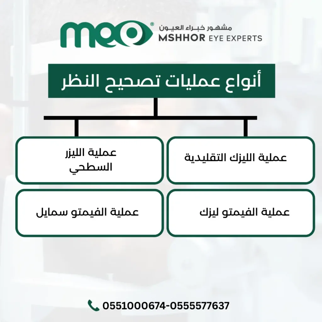 شروط عملية تصحيح النظر