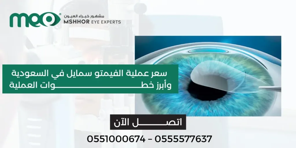  سعر عملية الفيمتو سمايل في السعودية