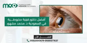 أفضل دكتور قرنية مخروطية