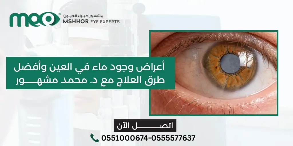 أعراض وجود ماء في العين