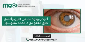 أعراض وجود ماء في العين