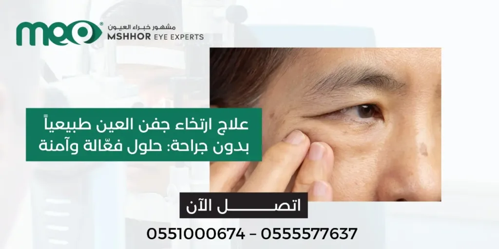 علاج ارتخاء جفن العين طبيعيا