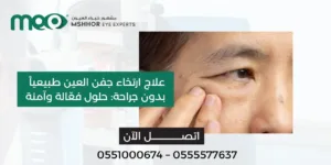 علاج ارتخاء جفن العين طبيعيا