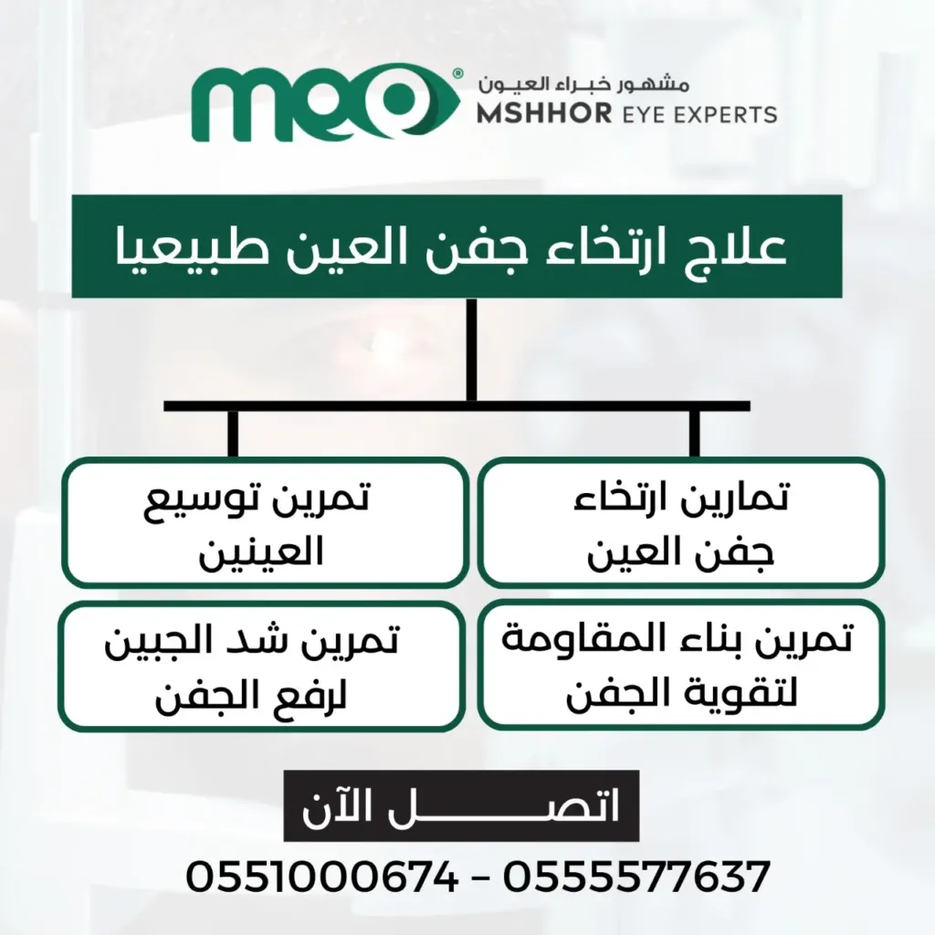 علاج ارتخاء جفن العين طبيعيا