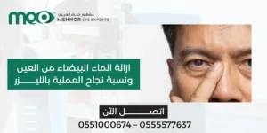 ازالة الماء البيضاء من العين