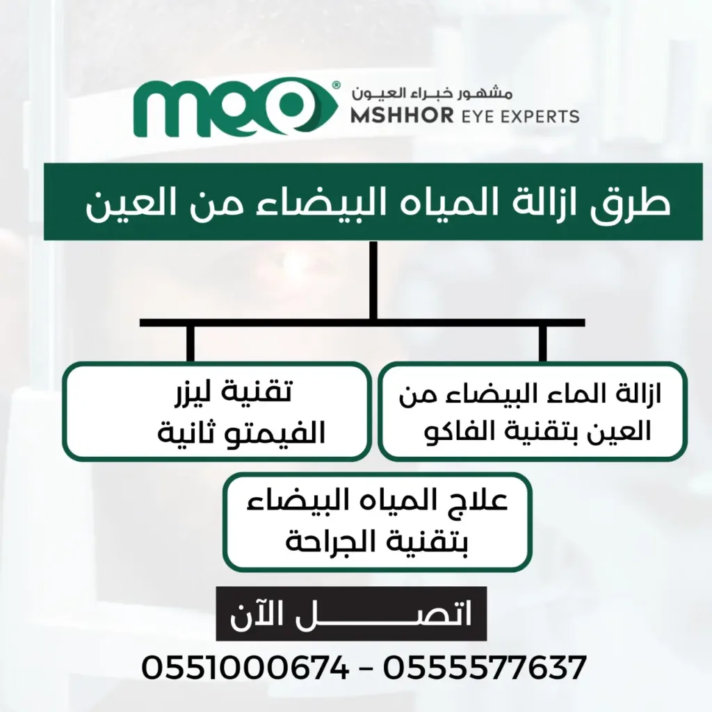 ازالة الماء البيضاء من العين