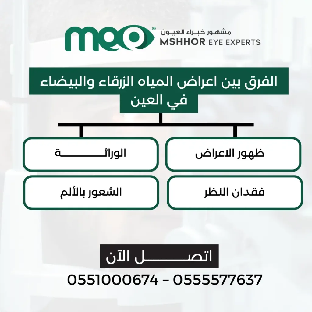 اعراض المياه الزرقاء والبيضاء في العين