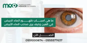 اسباب ظهور الماء الابيض في العين