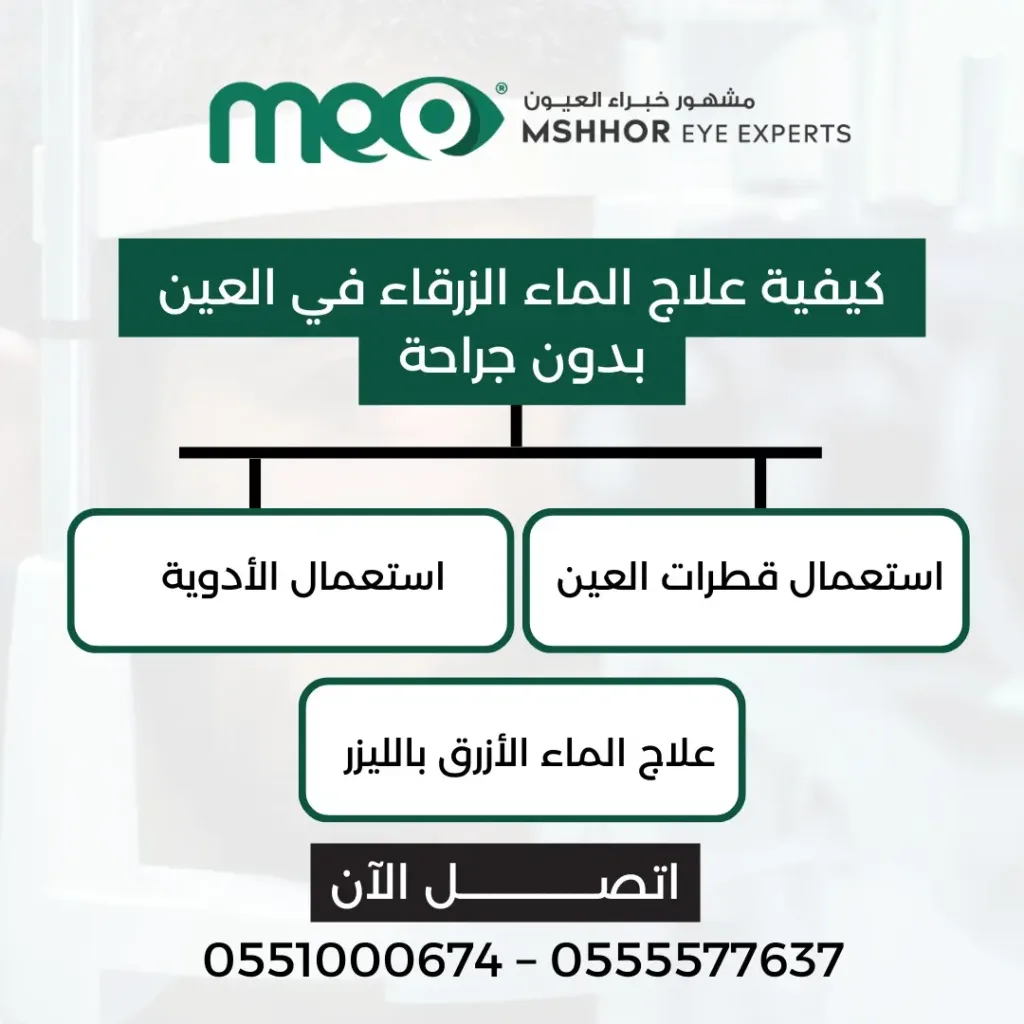 علاج الماء الزرقاء في العين