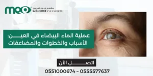 عملية الماء البيضاء في العين