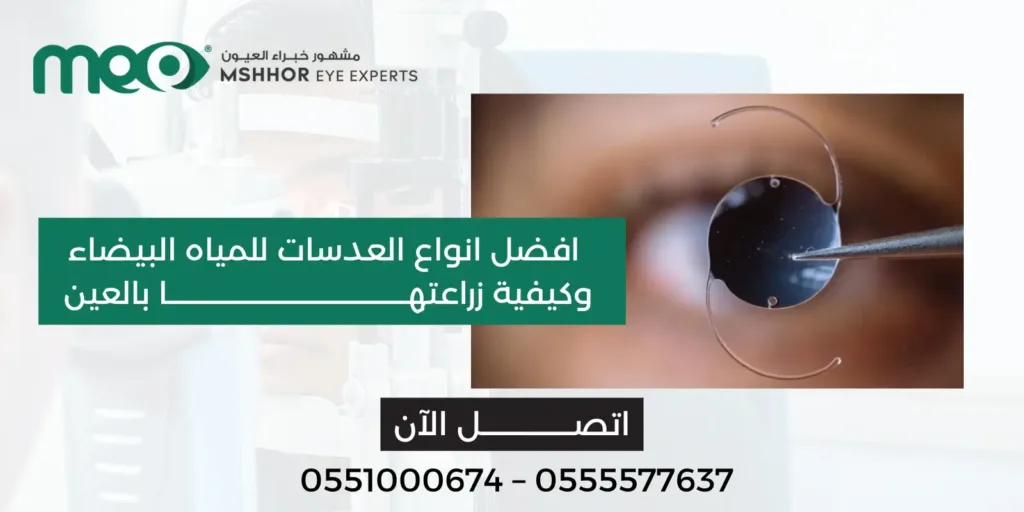 افضل انواع العدسات للمياه البيضاء