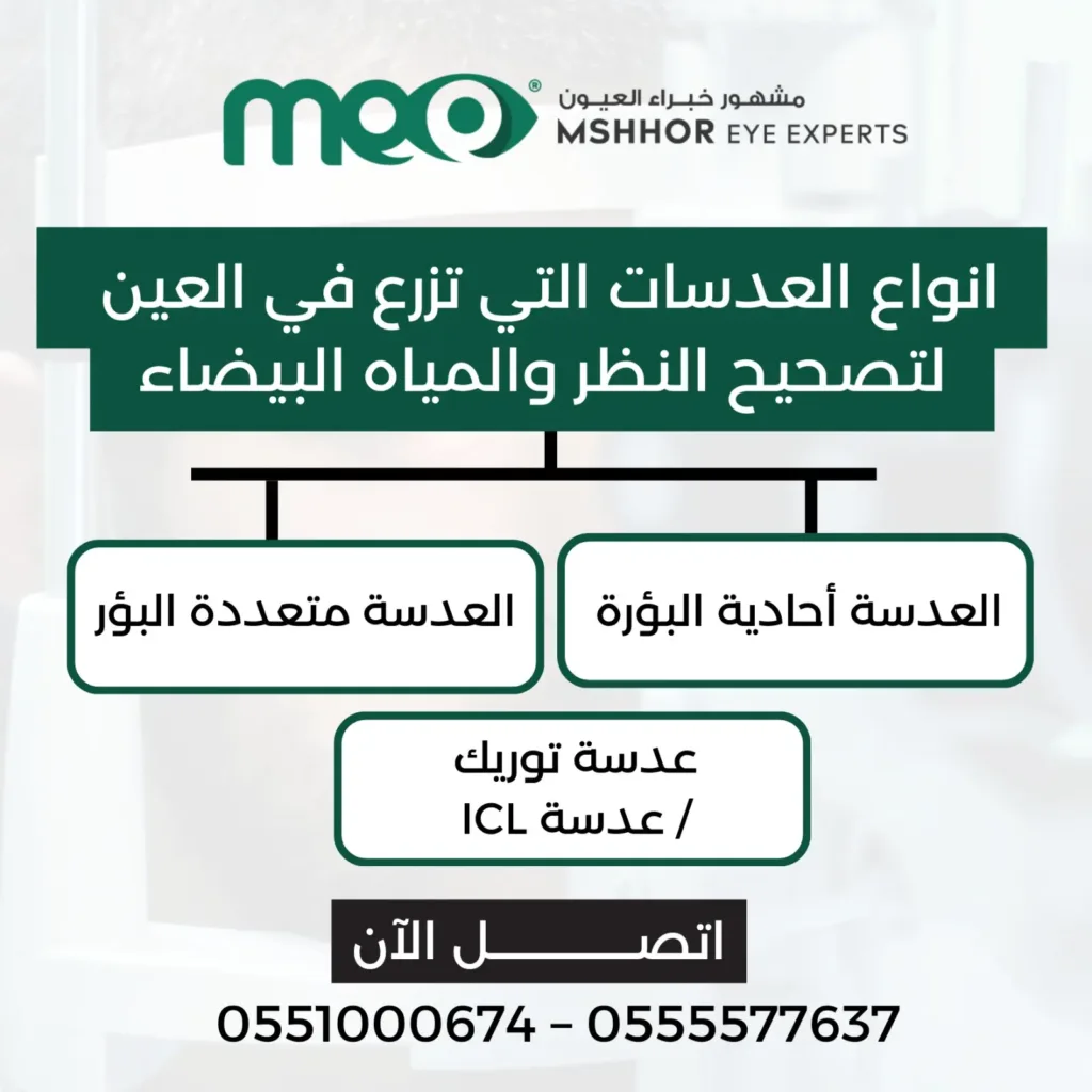 انواع العدسات التي تزرع في العين