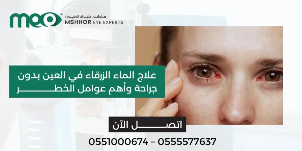 علاج الماء الزرقاء في العين