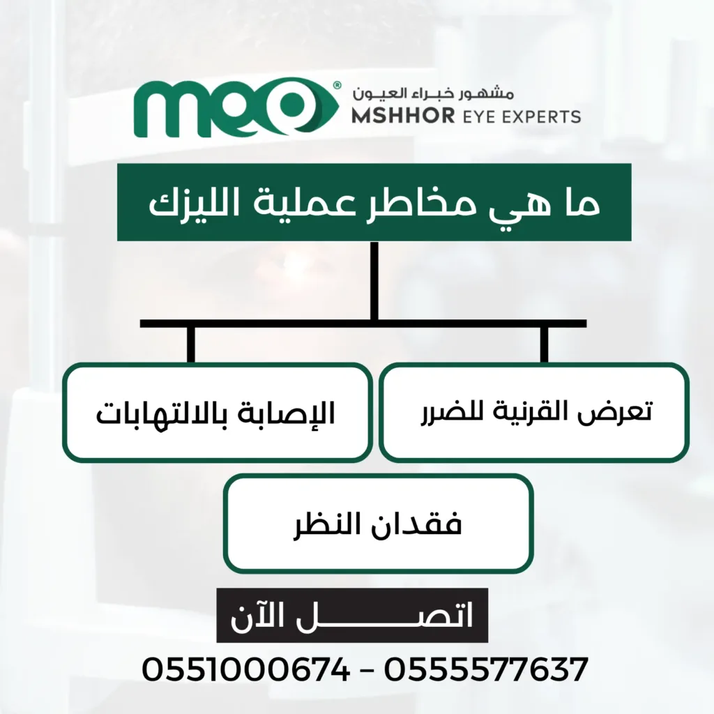 افضل انواع الليزك للعيون