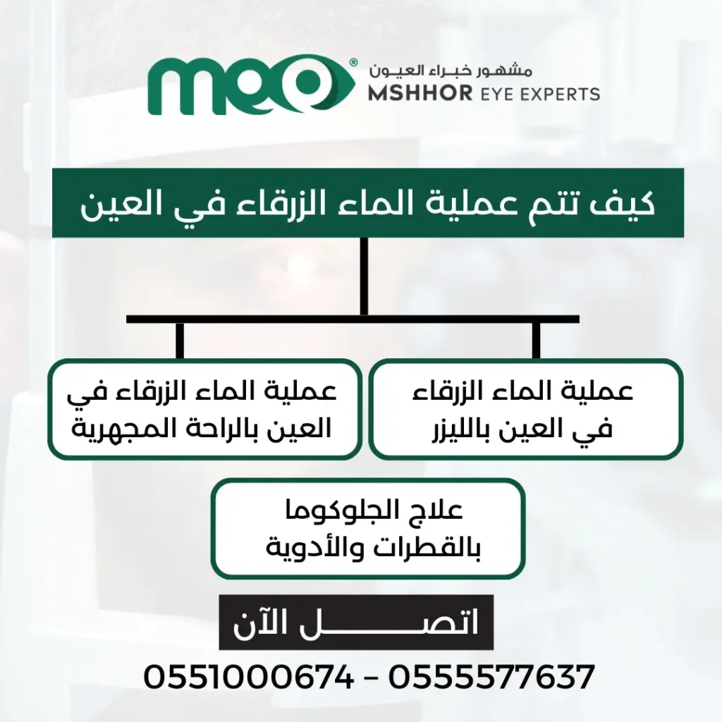 عملية الماء الزرقاء في العين