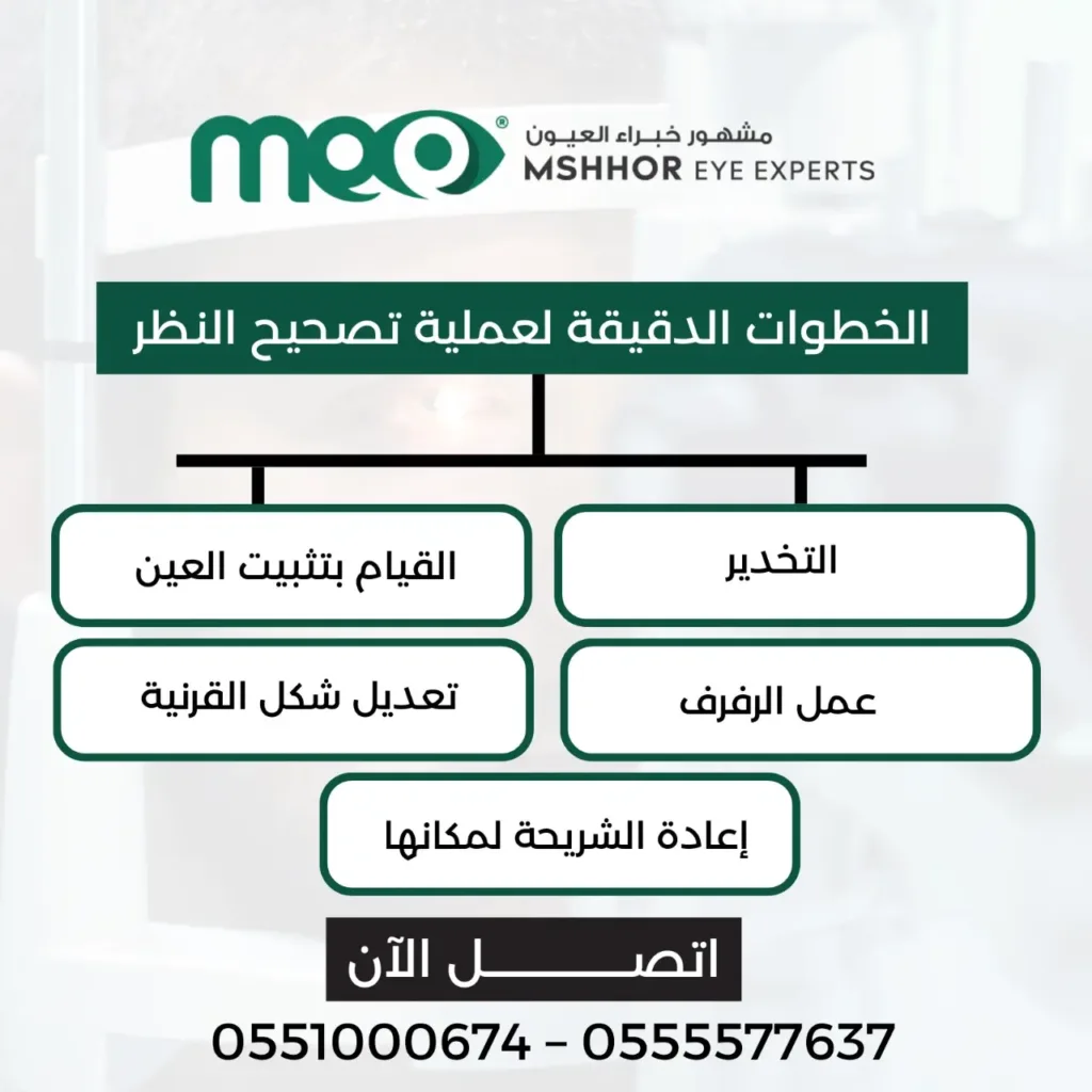 افضل دكتور تصحيح نظر في الرياض