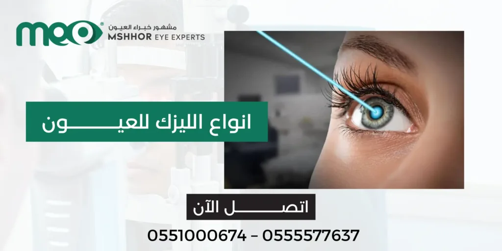 افضل انواع الليزك للعيون