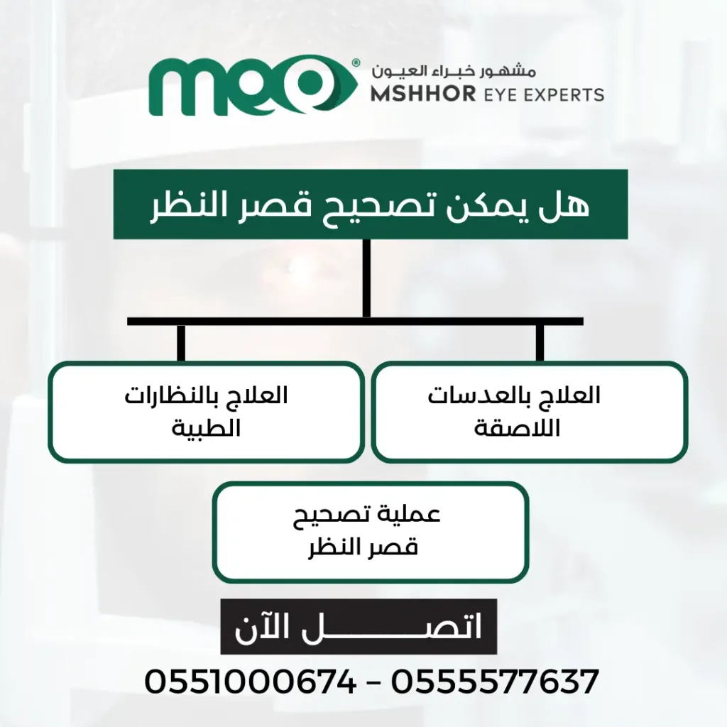 تصحيح قصر النظر