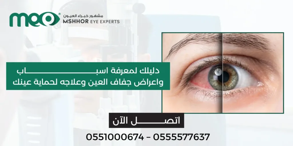 اسباب واعراض جفاف العين