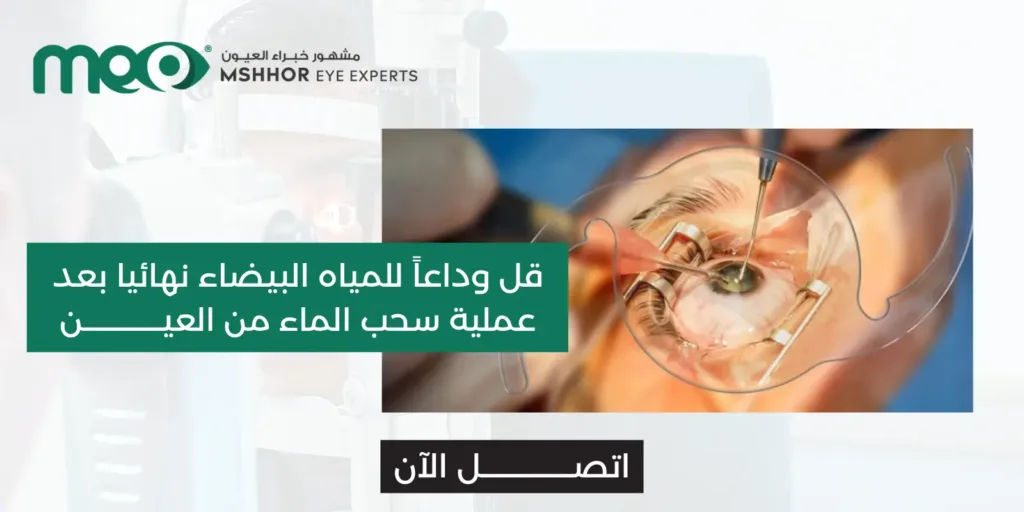 عملية سحب الماء من العين